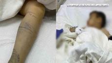 توضيحات حصرية لـ “زاكورة نيوز” حول تعرض طفل للدغة أفعى بمركز زاكورة زاكورة نيوز…