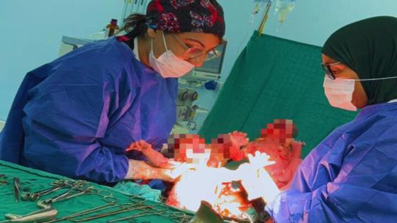 رعــــاية.. تدخل طبي إستعجالي يــؤمن ولادة قيصرية لثلاثة توائم في ظروف صحية جيدة…